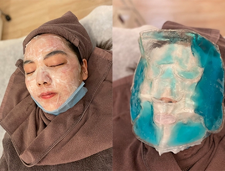 Picoplus皮秒雷射｜去除臉部斑點，重回滑嫩肌膚(圖)