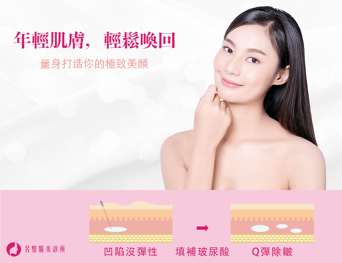 喬雅登（Juvederm）玻尿酸