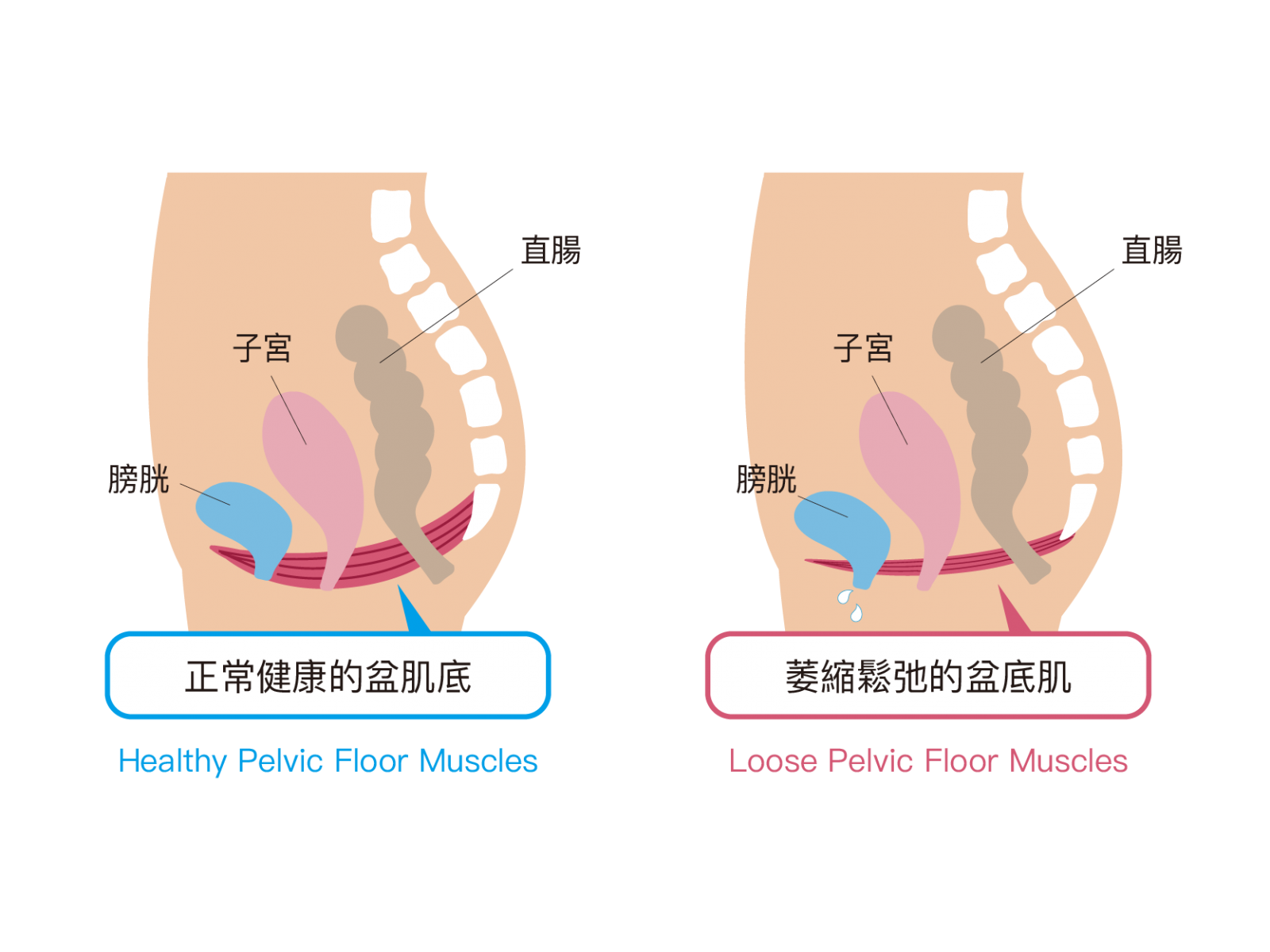 男女都需要盆底肌保健｜Hipex肌動椅